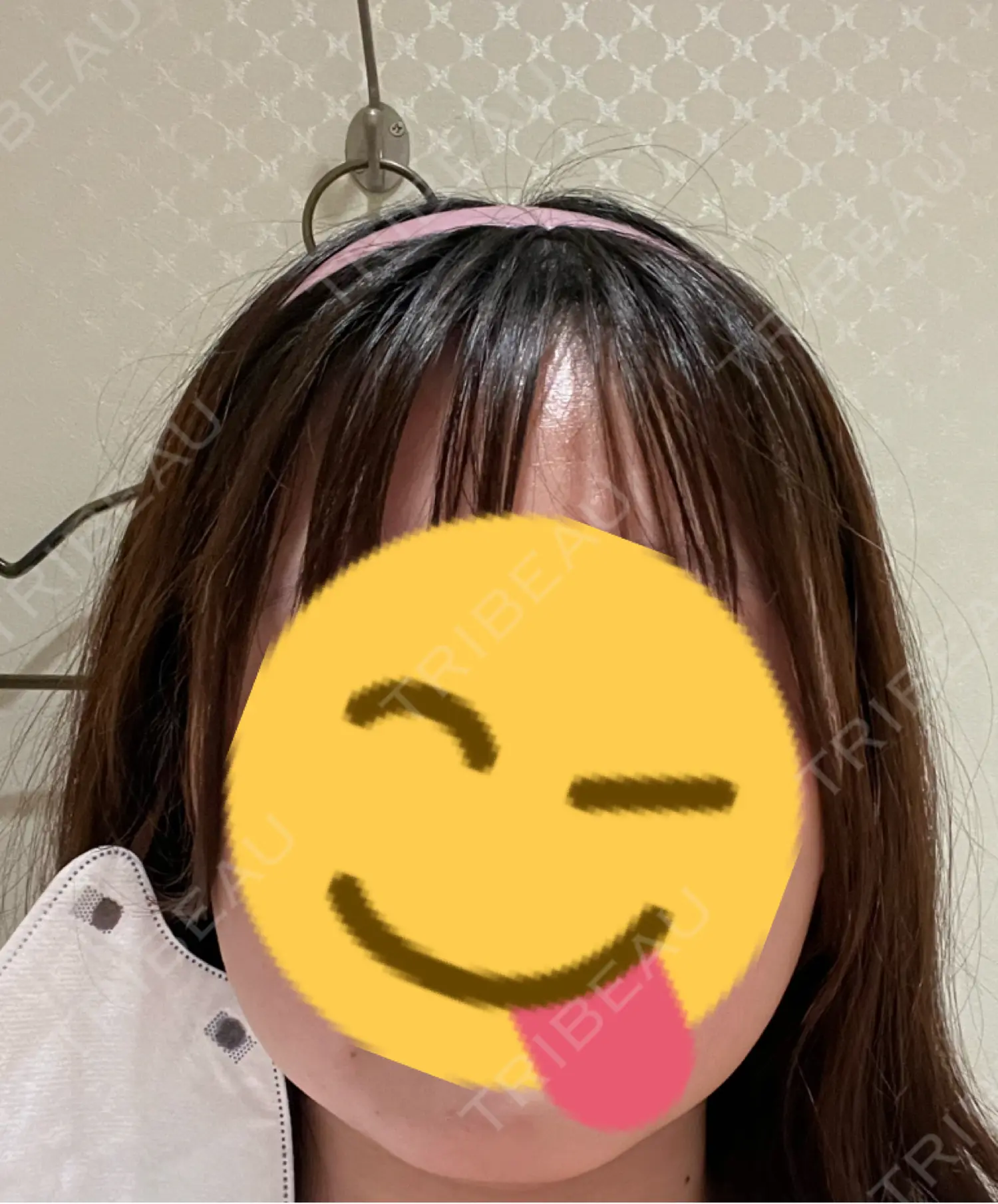 施術後の写真