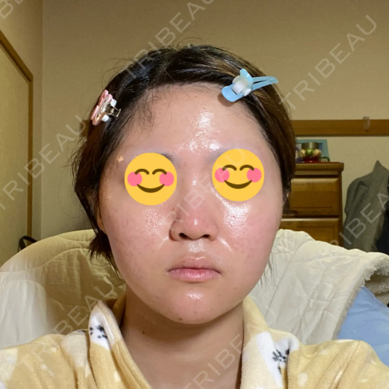 施術後の写真