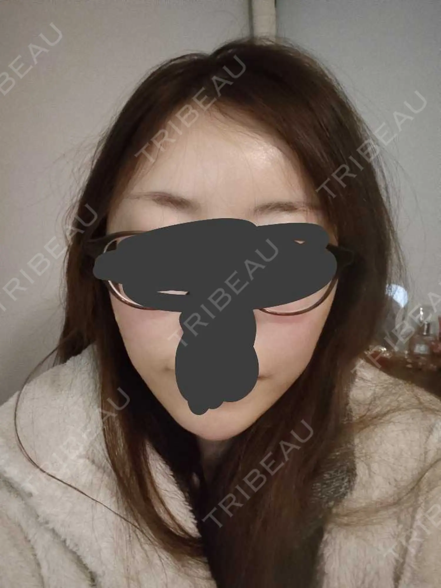 施術後の写真