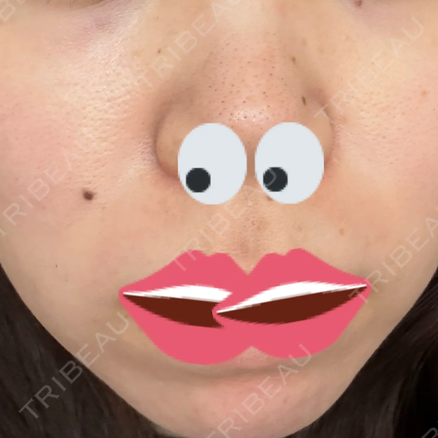 施術後の写真