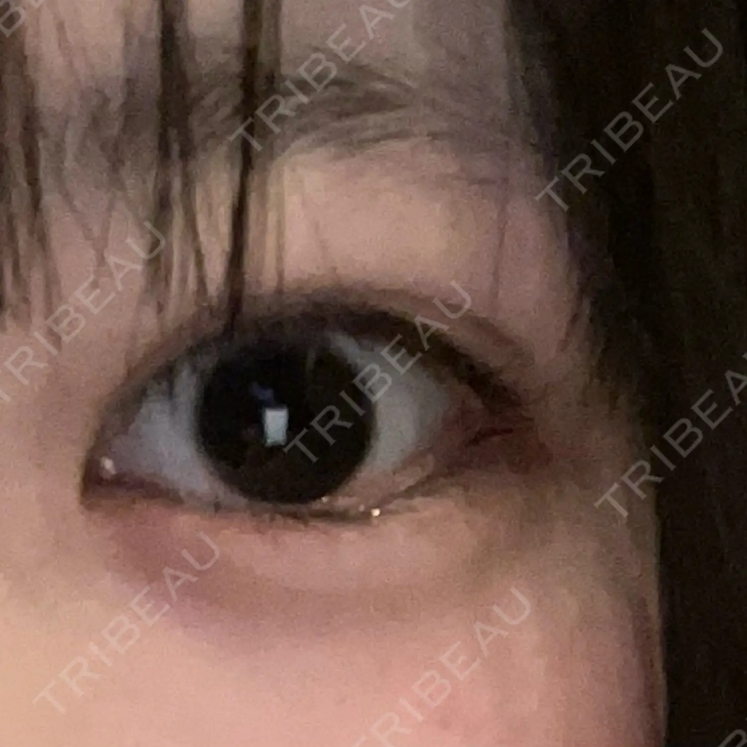 施術後の写真