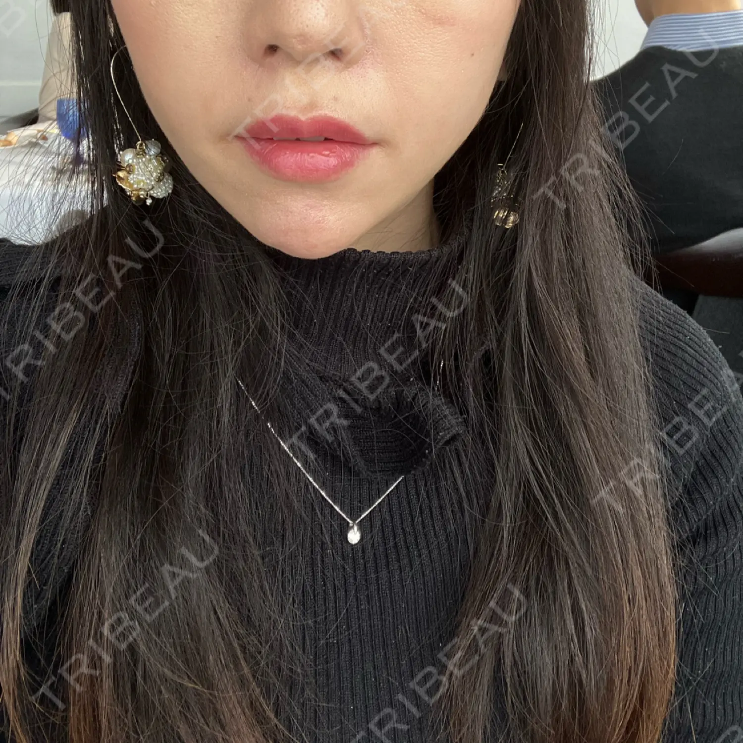施術後の写真