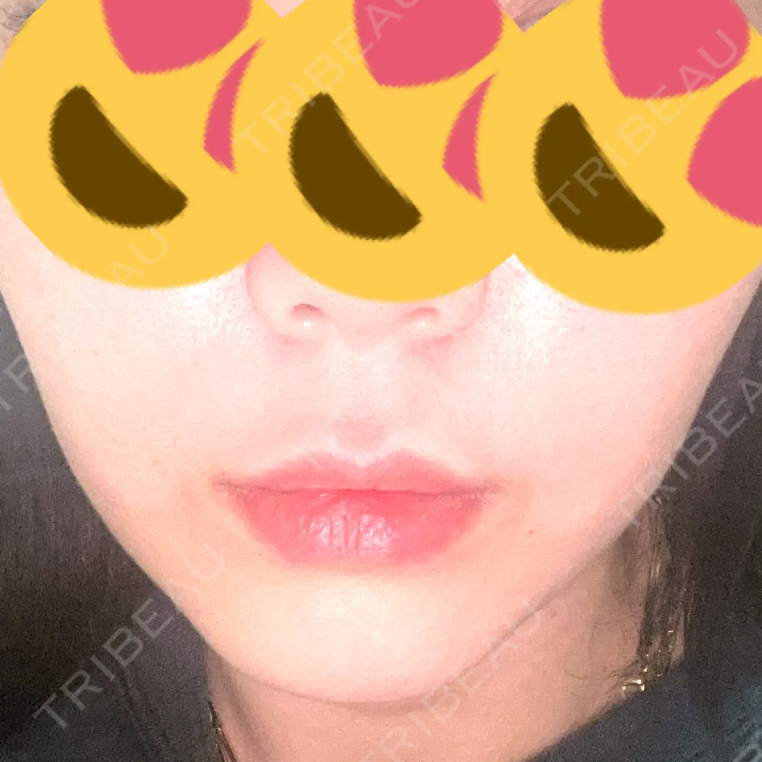 施術後の写真