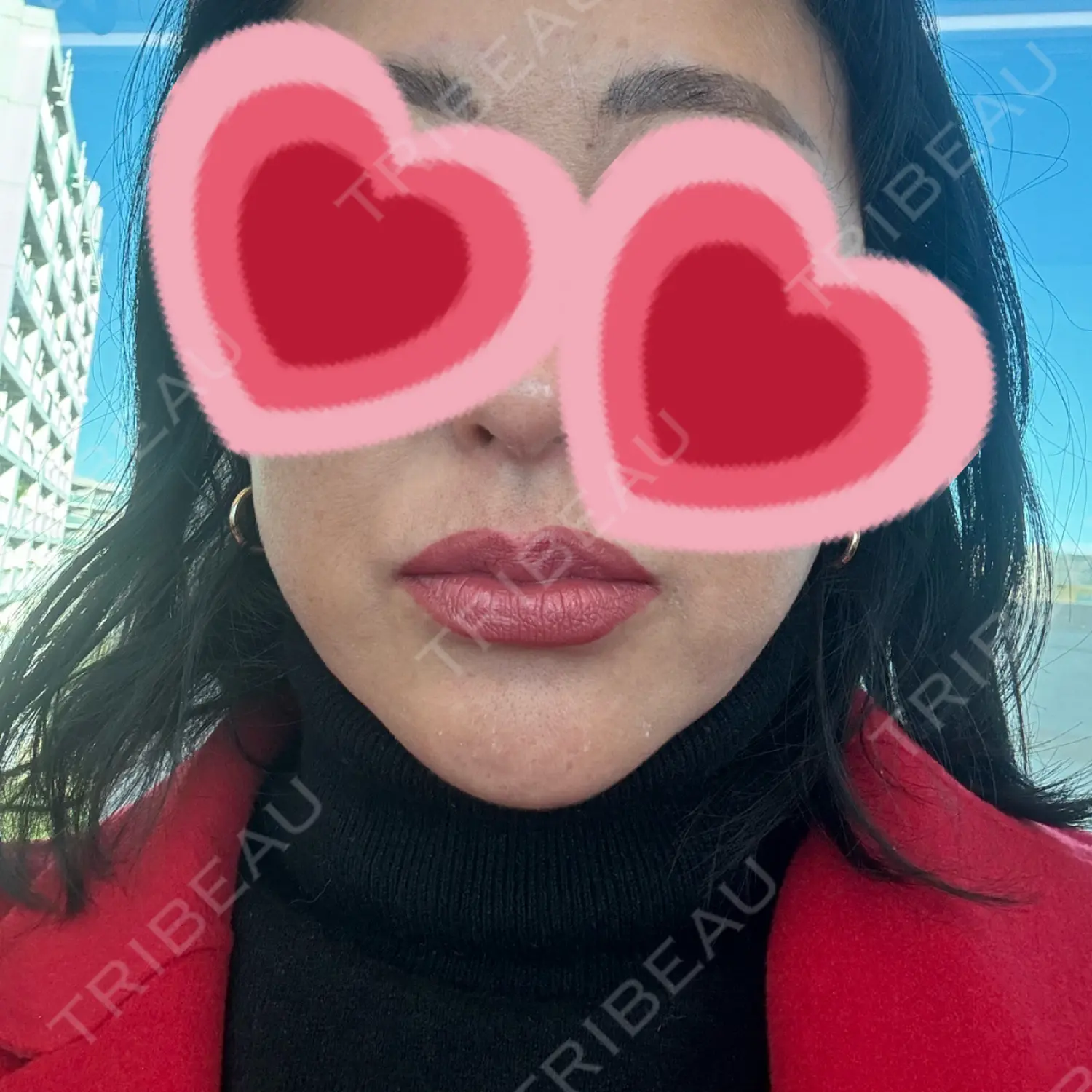 施術後の写真