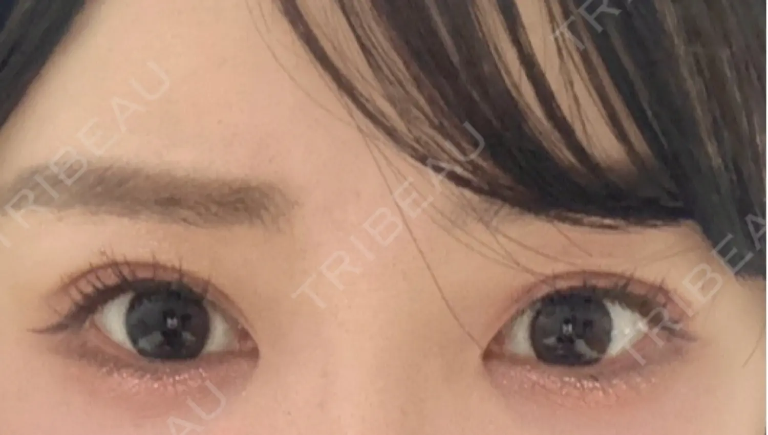 施術後の写真