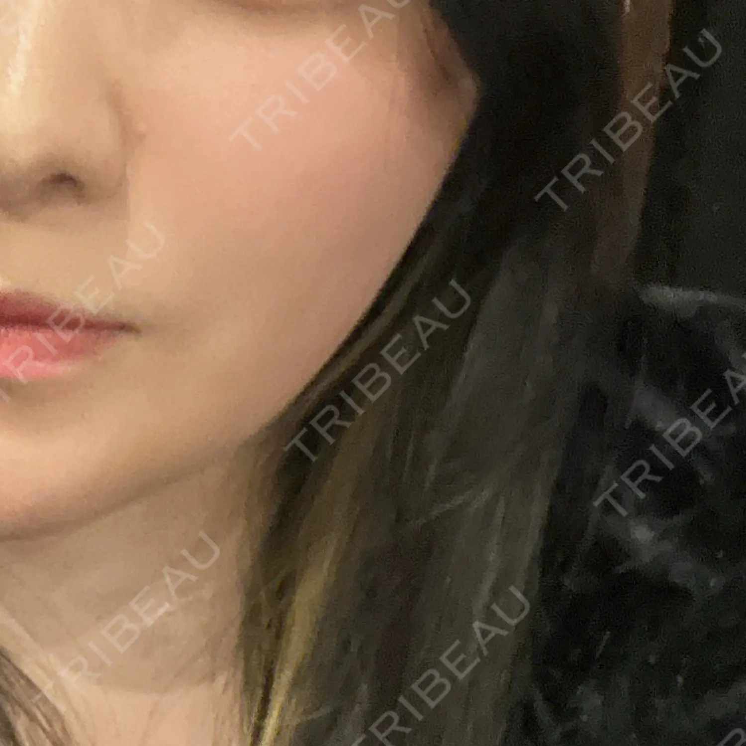 施術後の写真