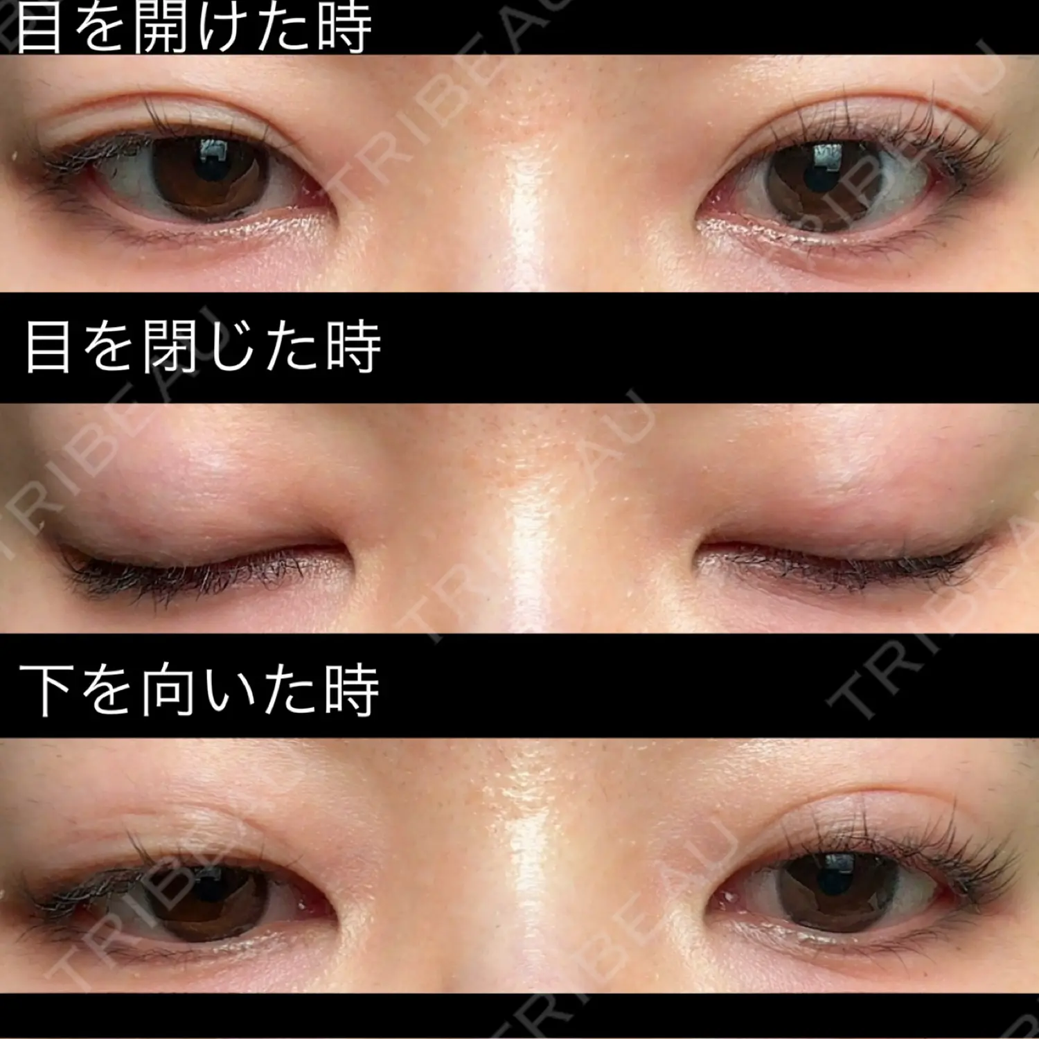 施術後の写真
