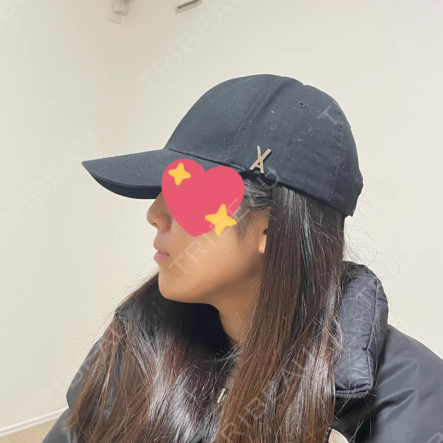 施術後の写真