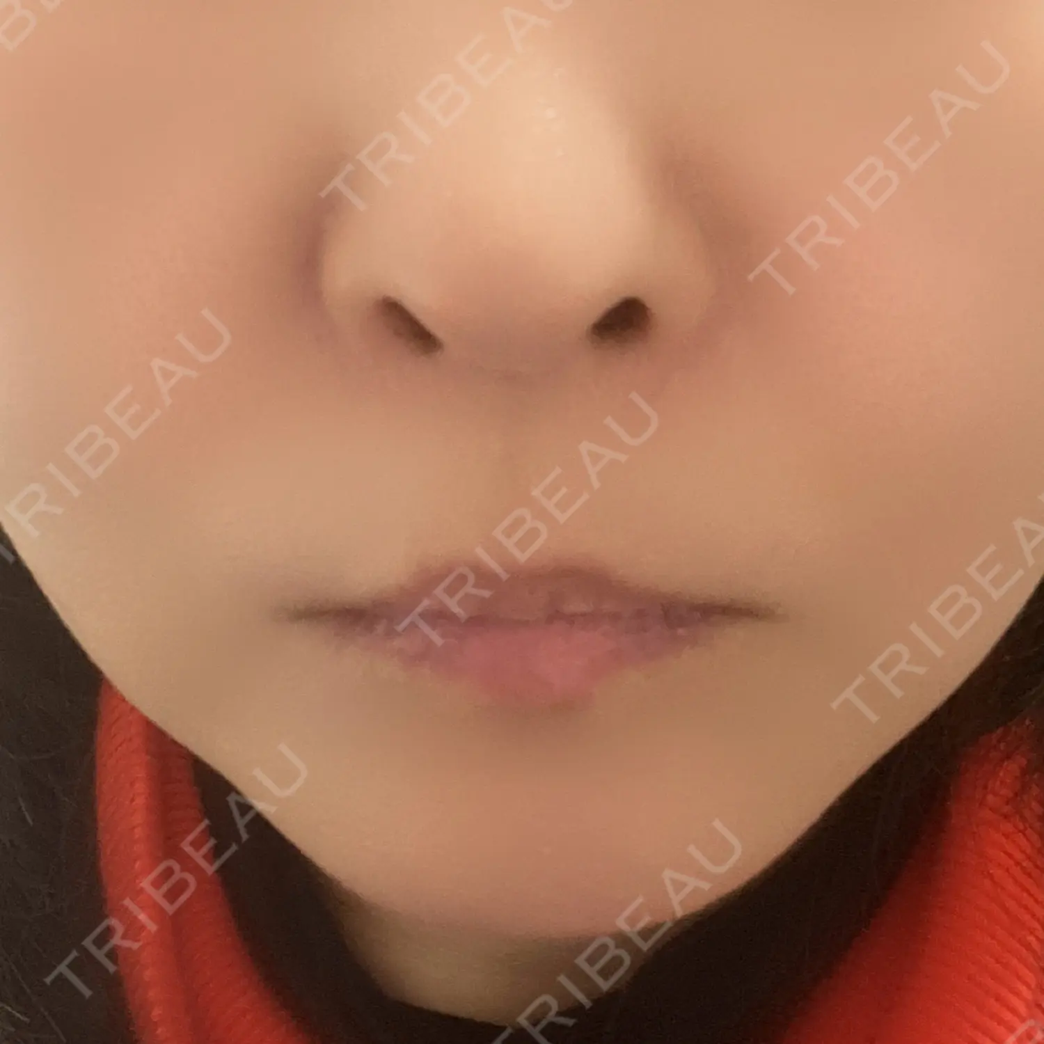 施術後の写真