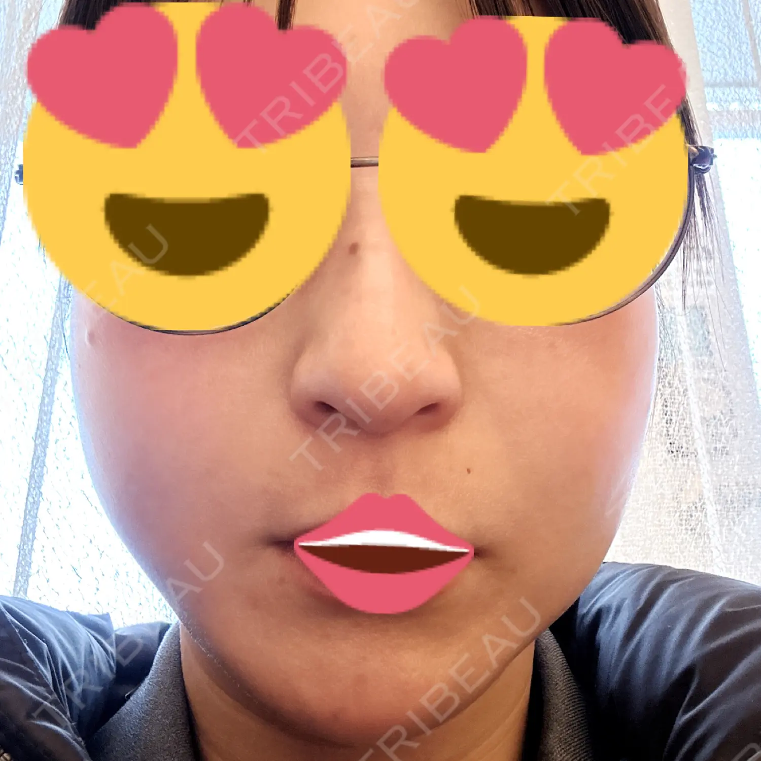 施術後の写真