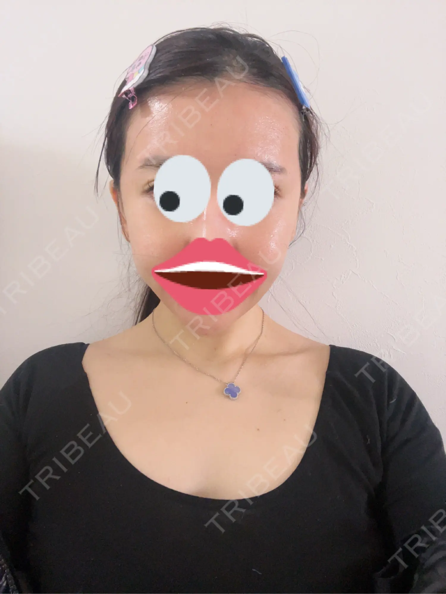 施術後の写真