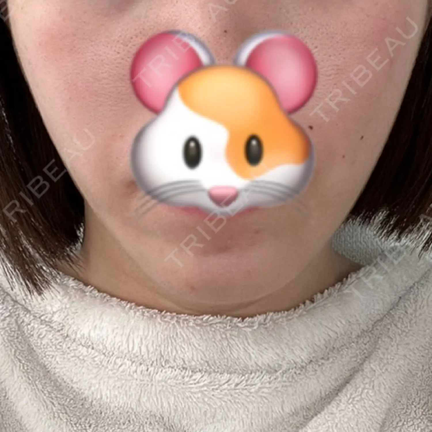施術後の写真