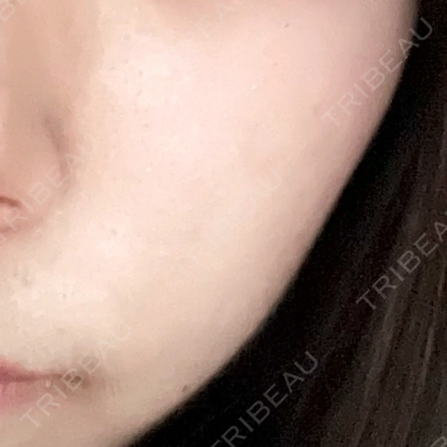 施術後の写真