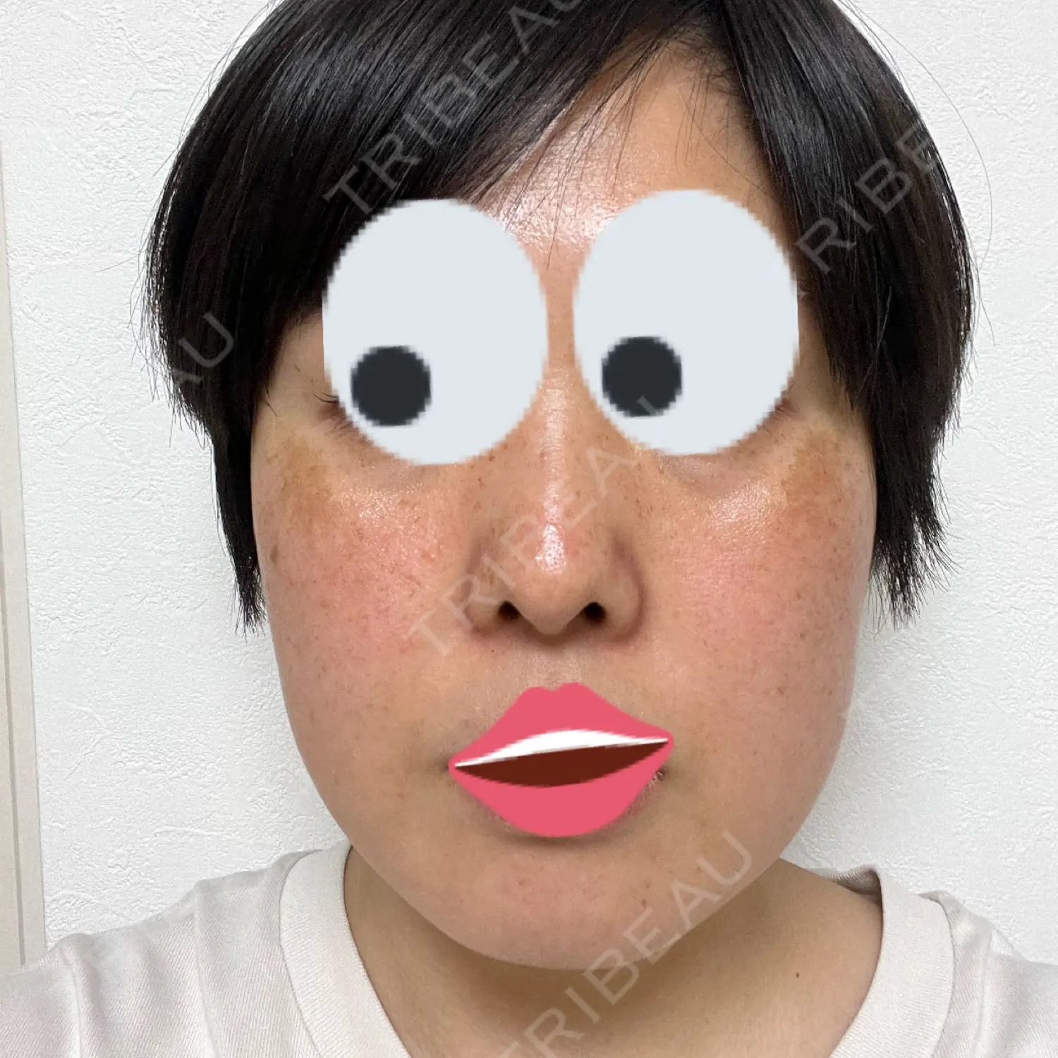 施術後の写真