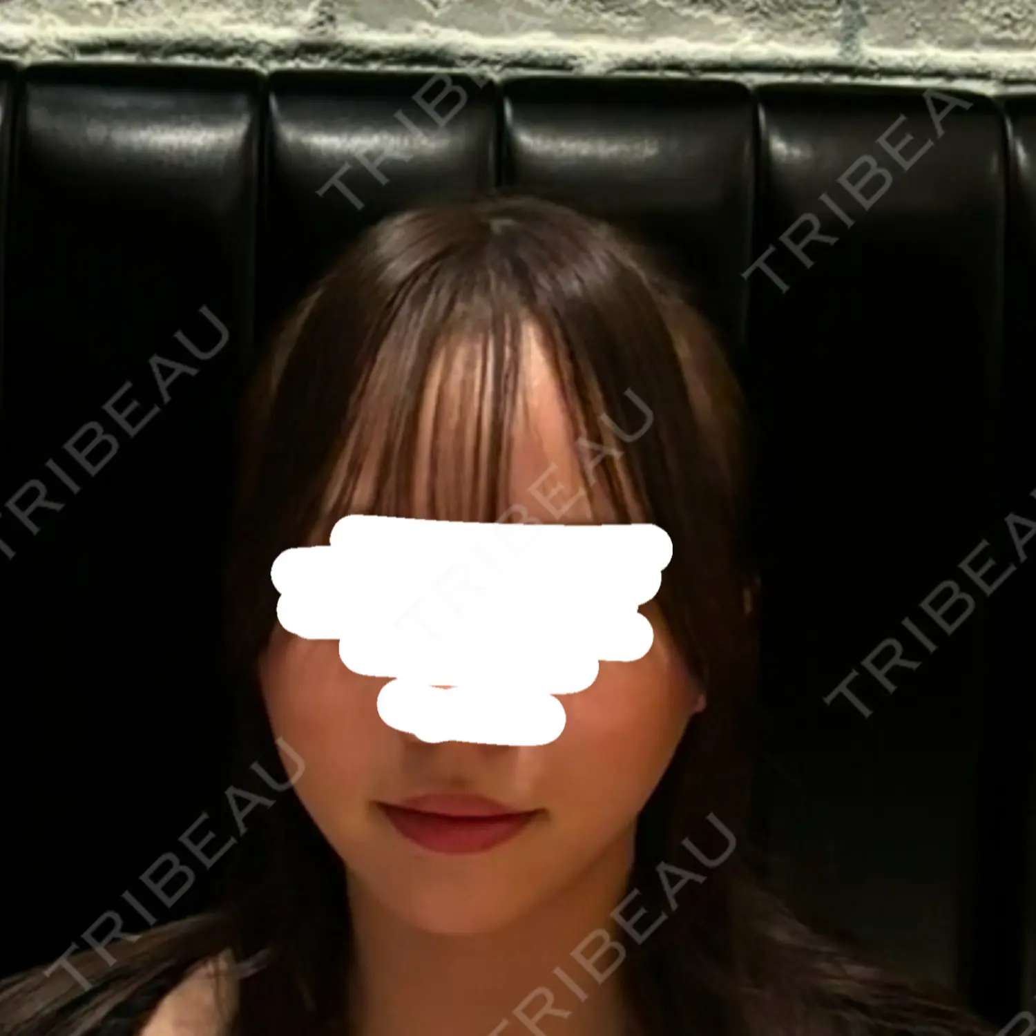 施術後の写真