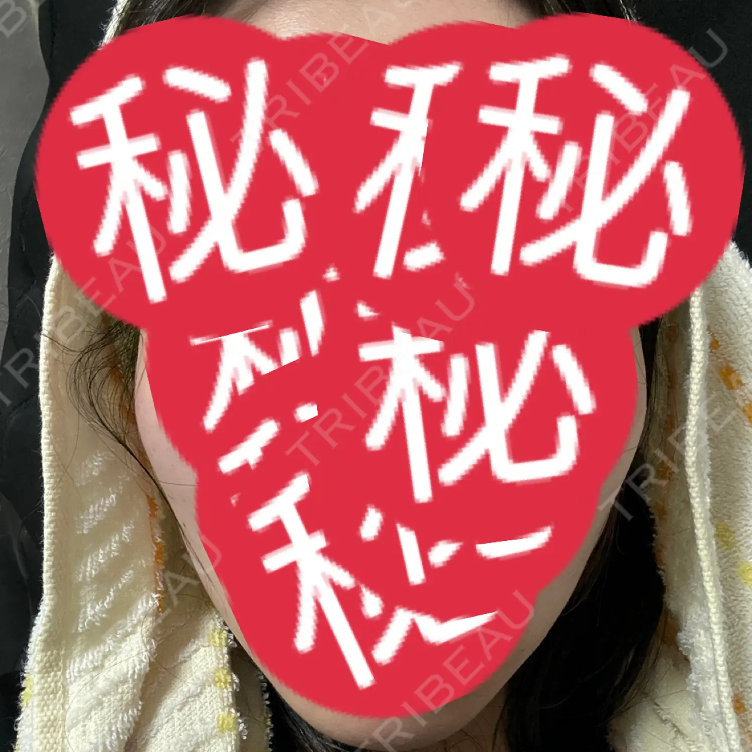 施術後の写真