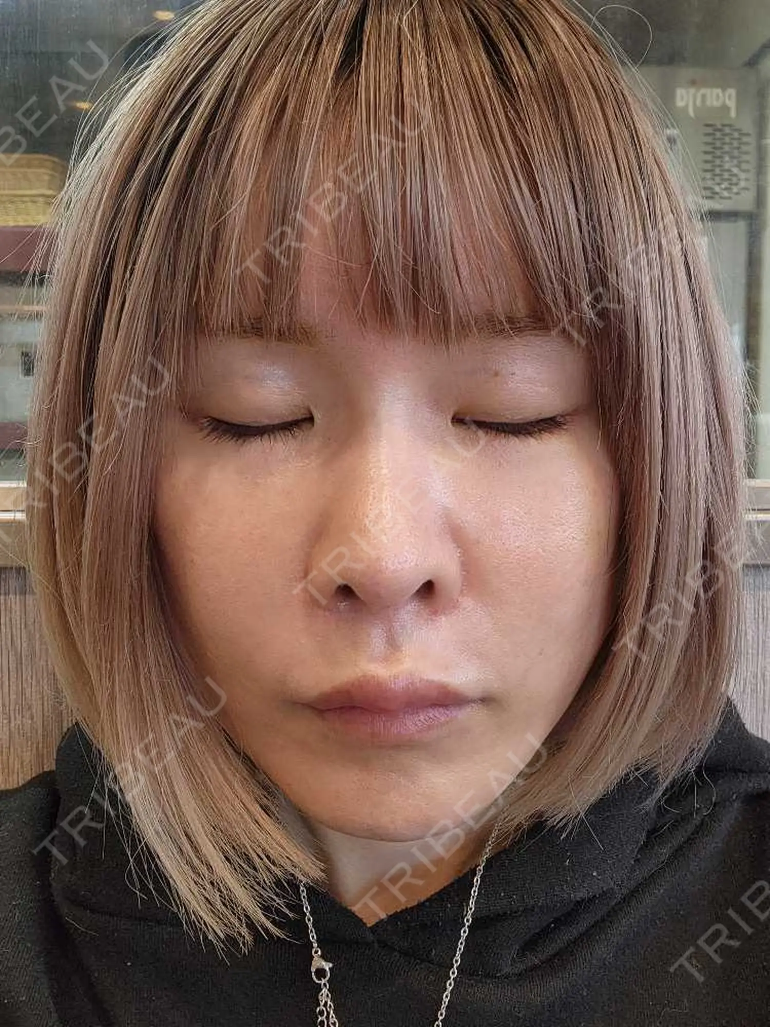 施術後の写真