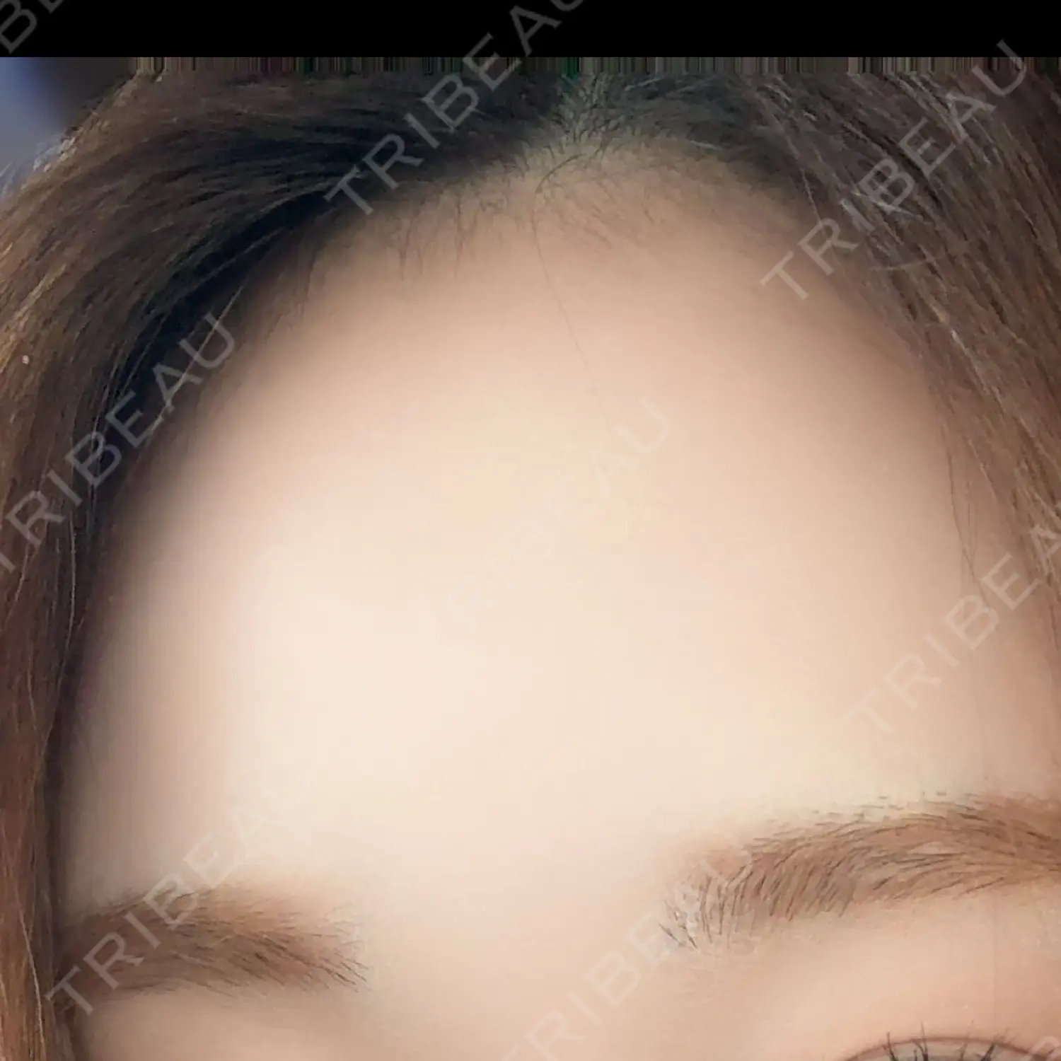 施術後の写真