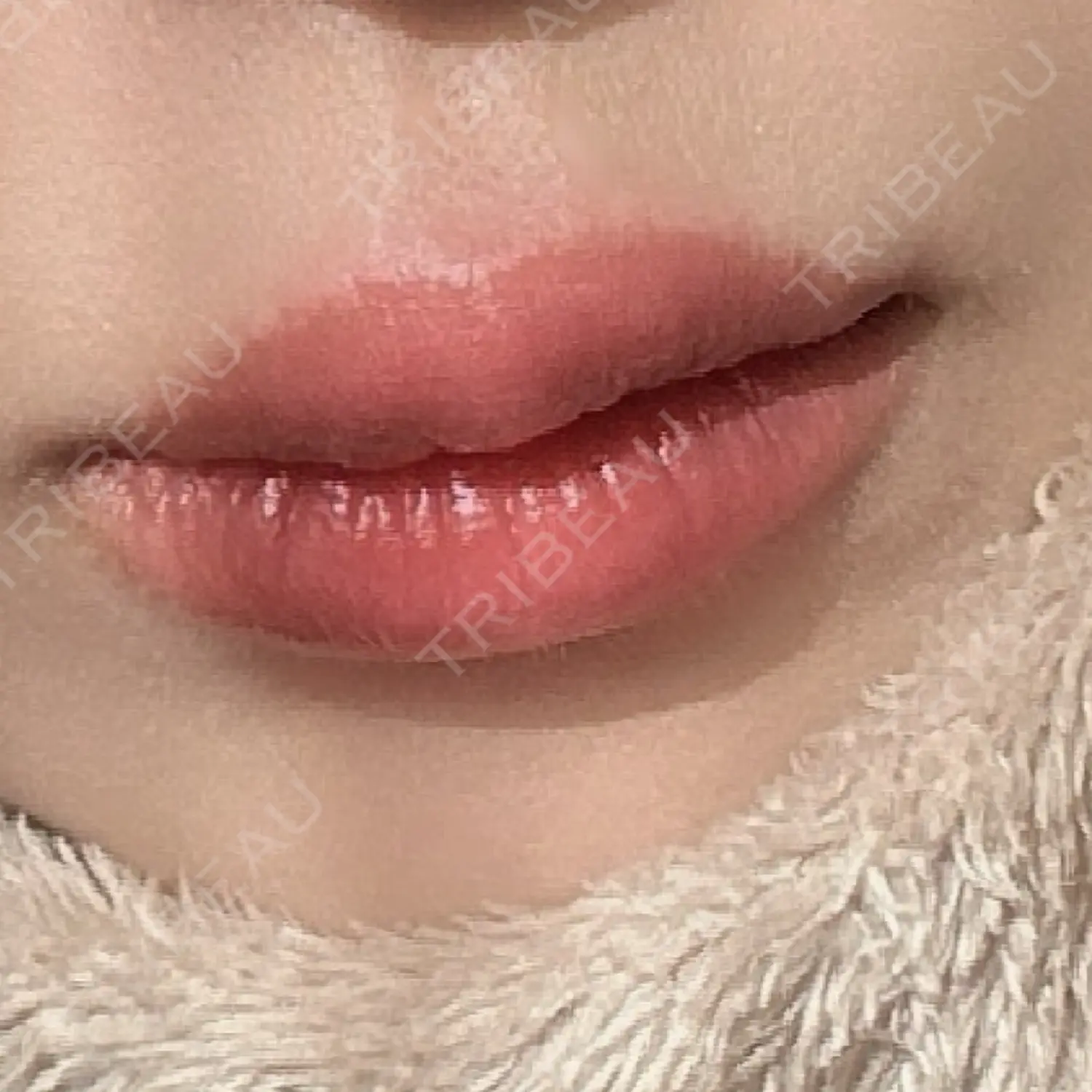 施術後の写真
