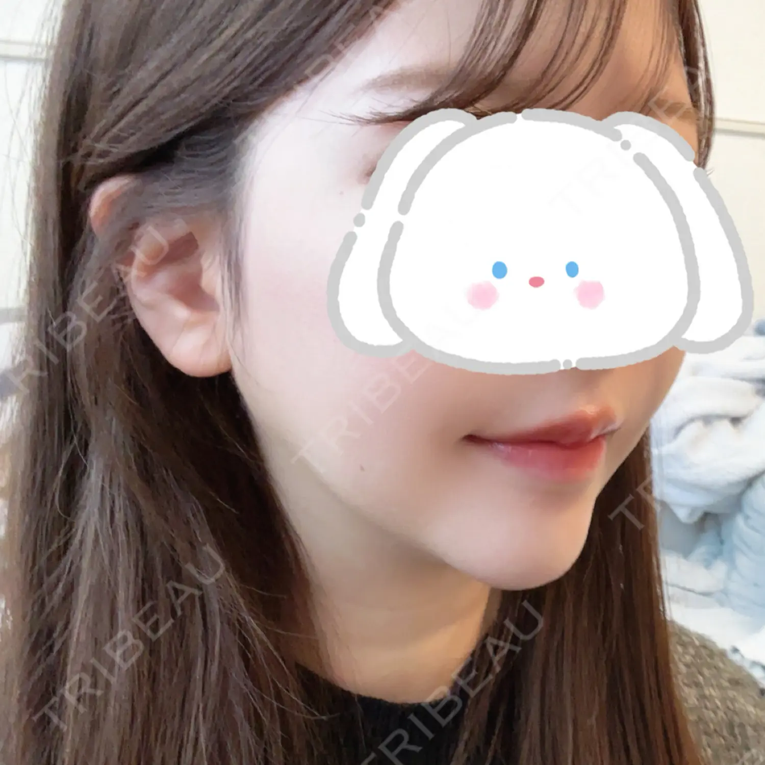 施術後の写真