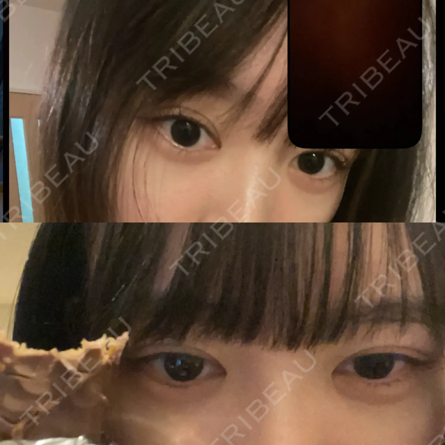 施術後の写真