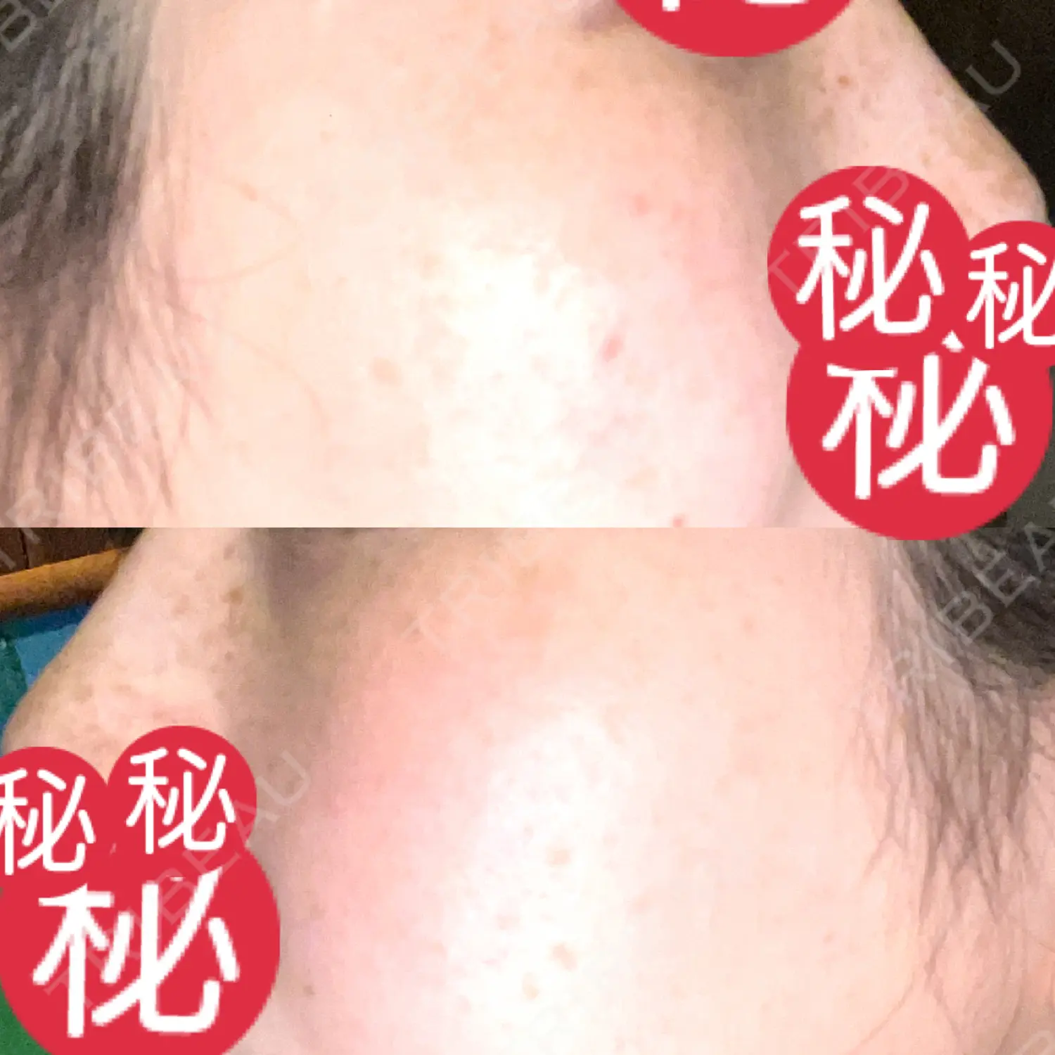 施術後の写真