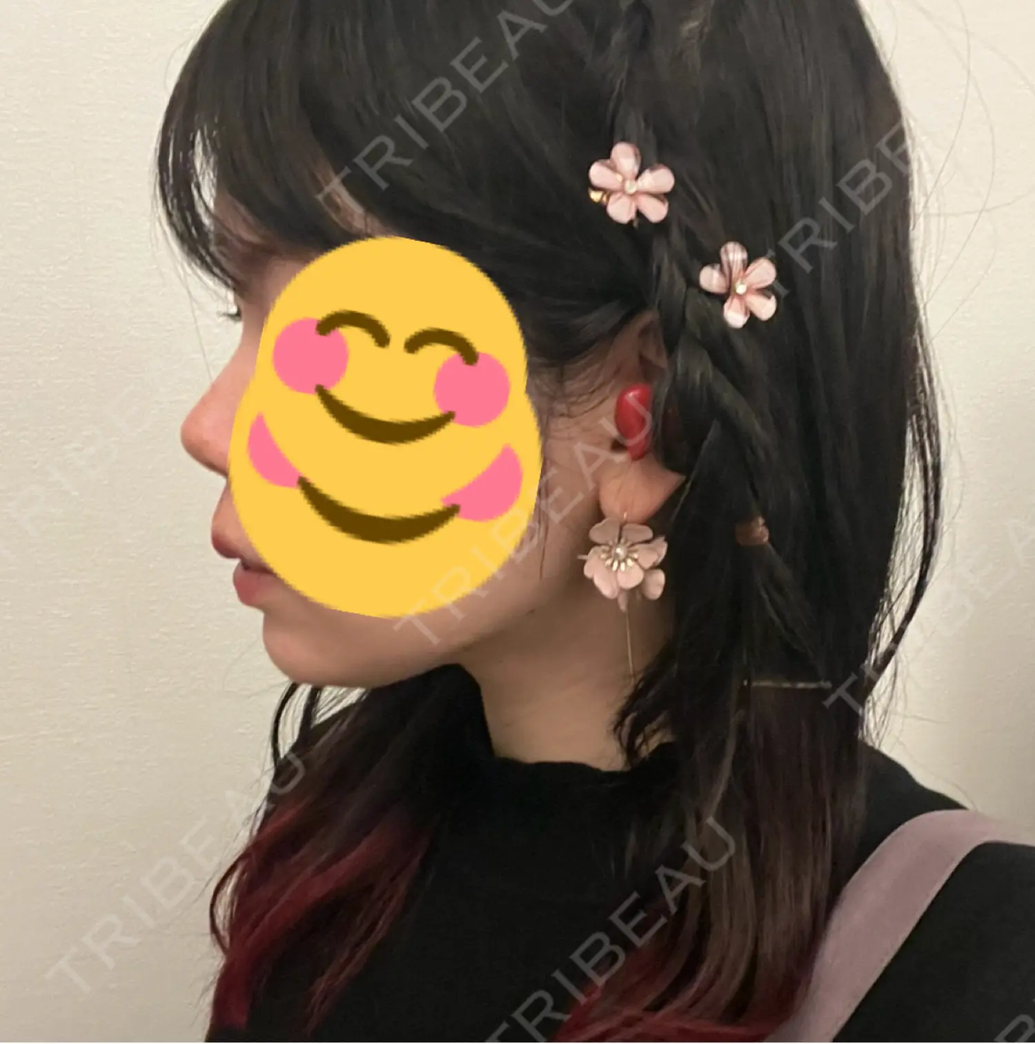 施術後の写真