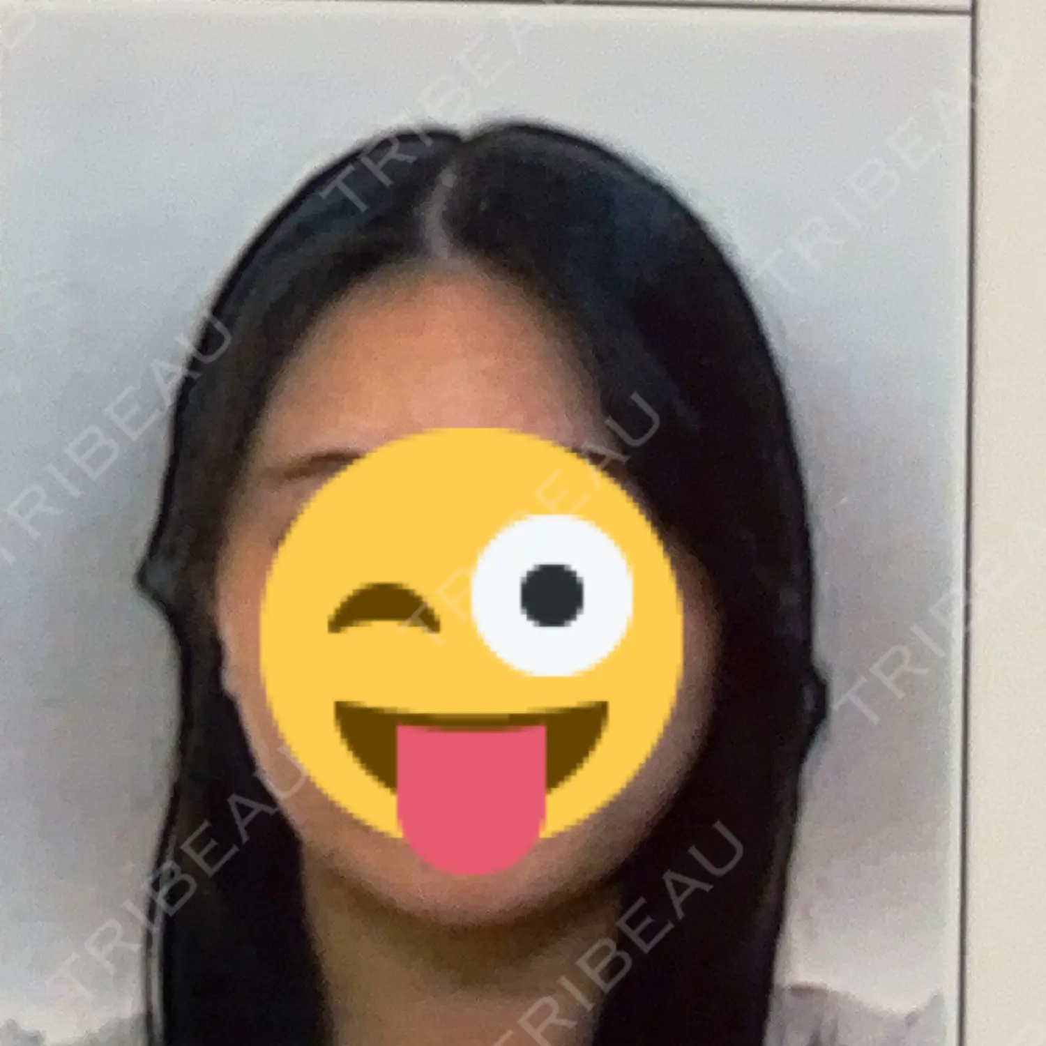 施術後の写真