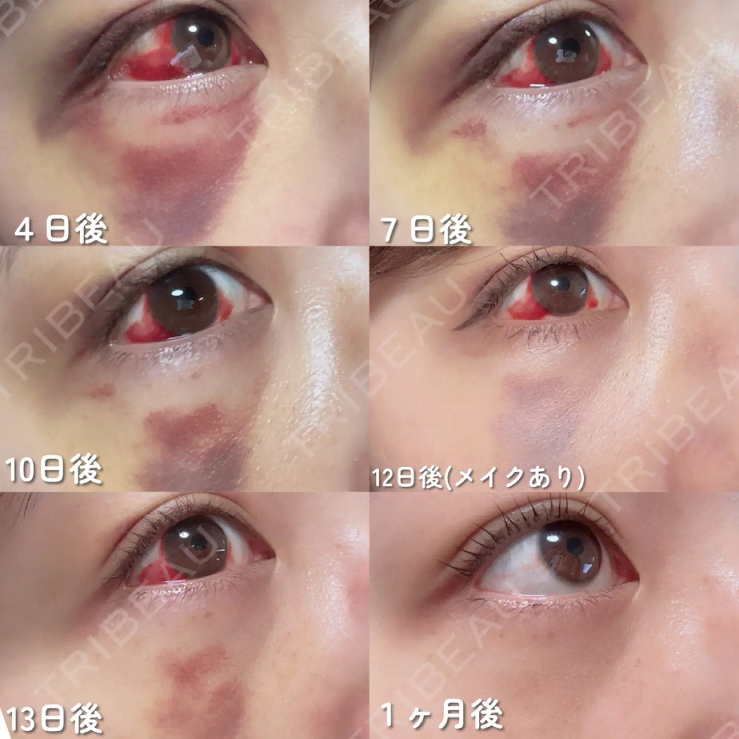施術後の写真