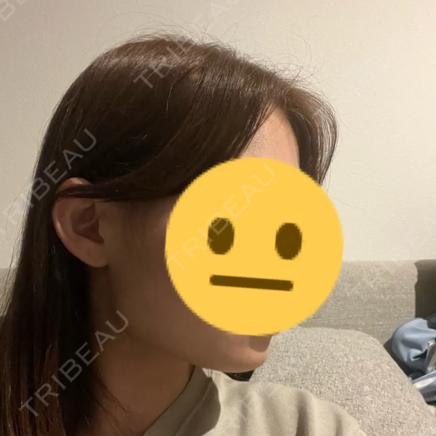 施術後の写真