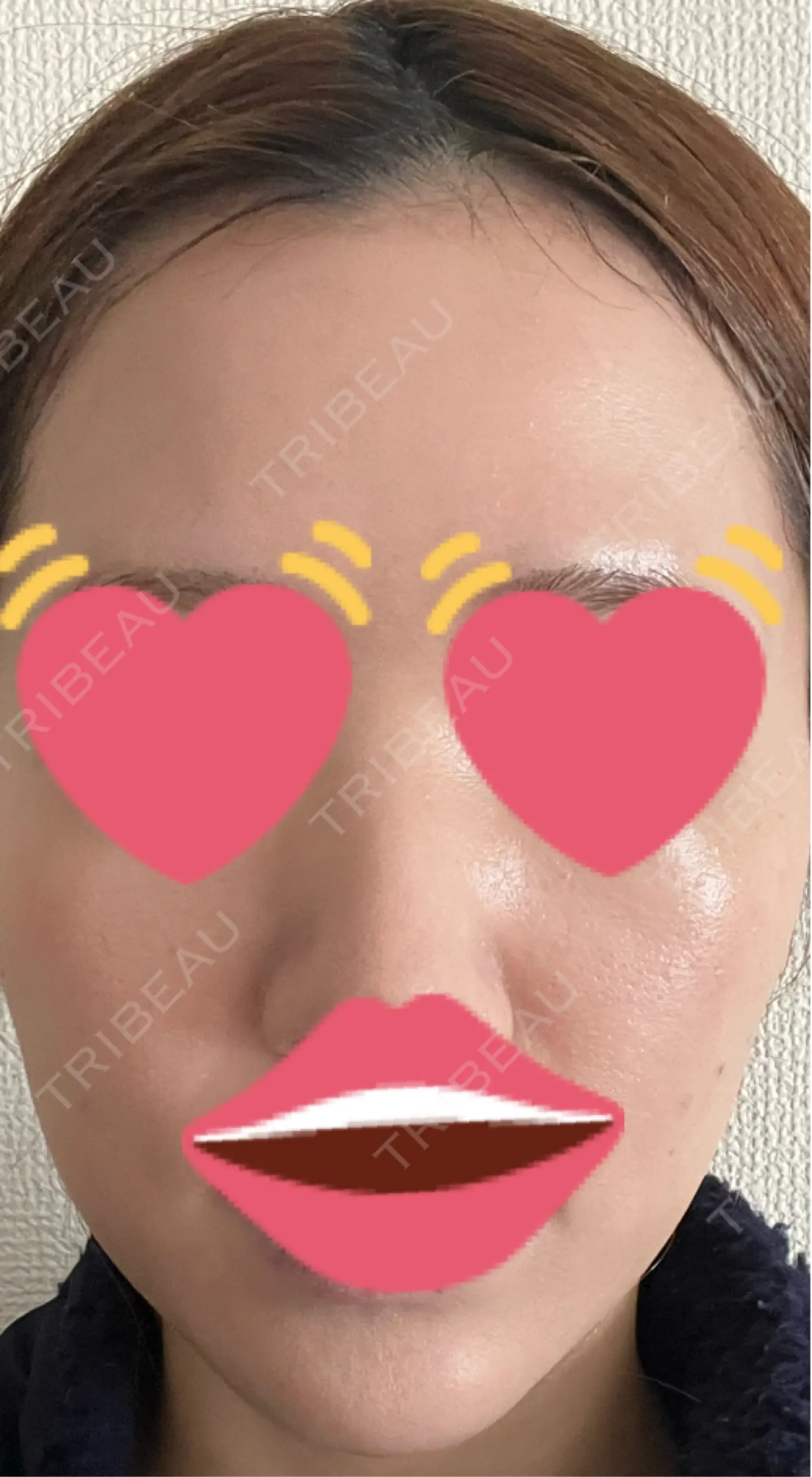 施術後の写真
