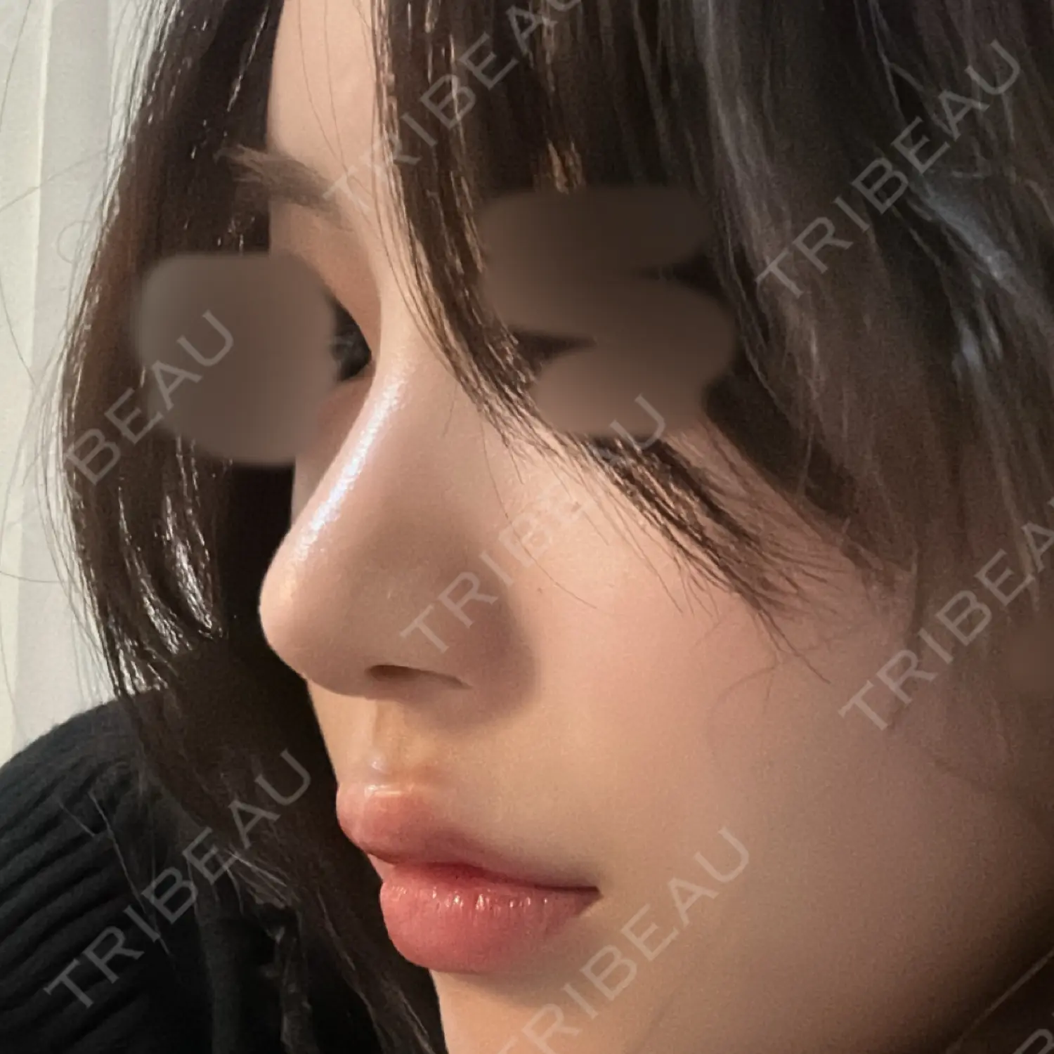 施術後の写真