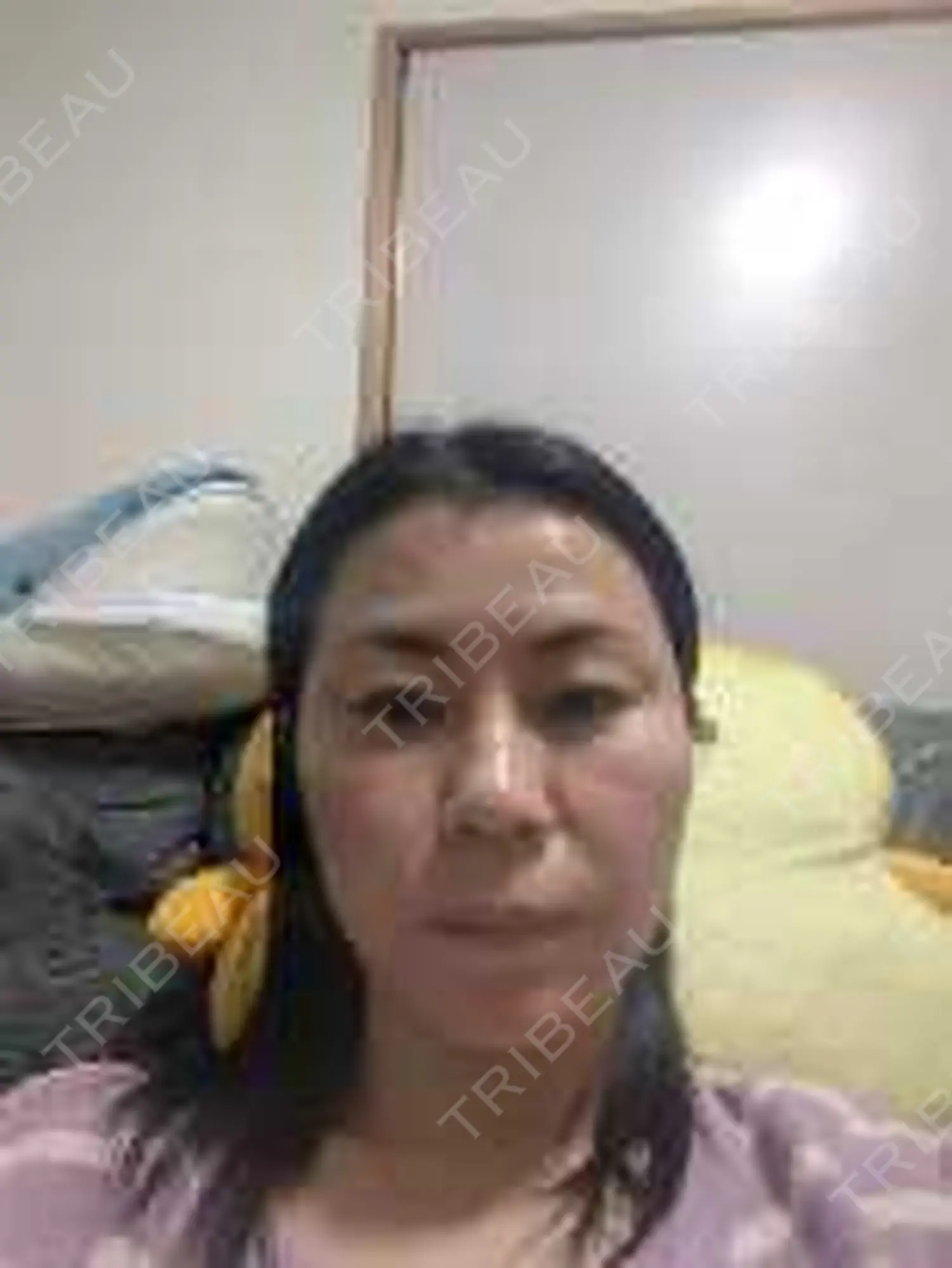 施術後の写真