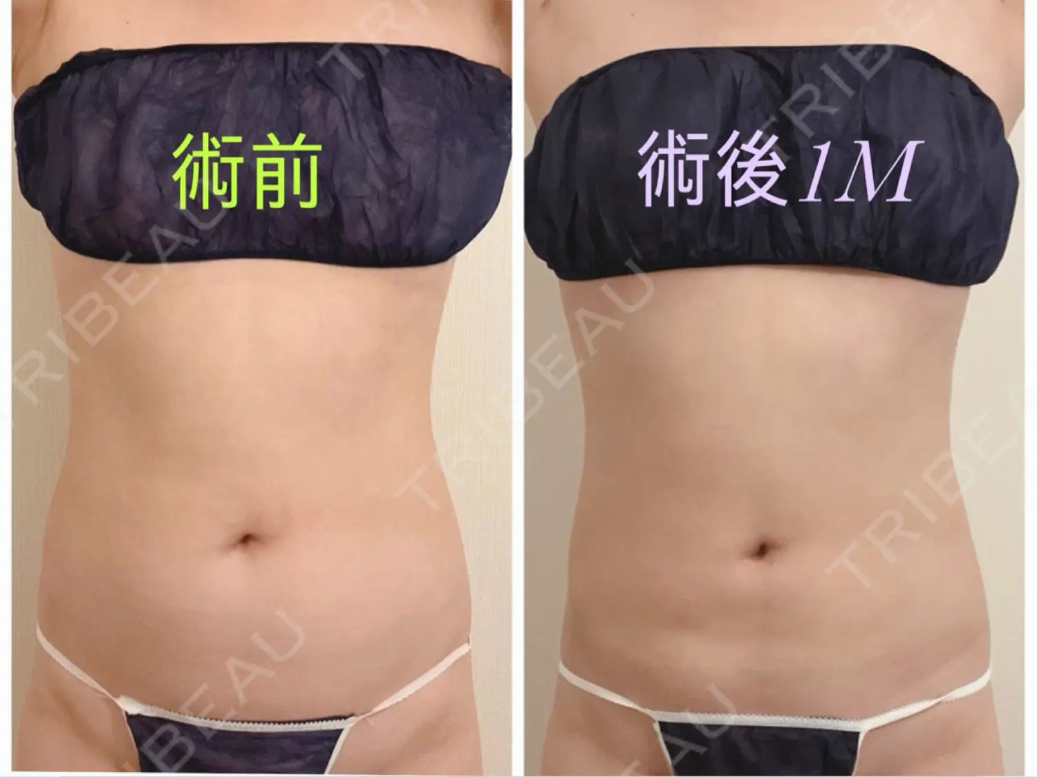 施術後の写真