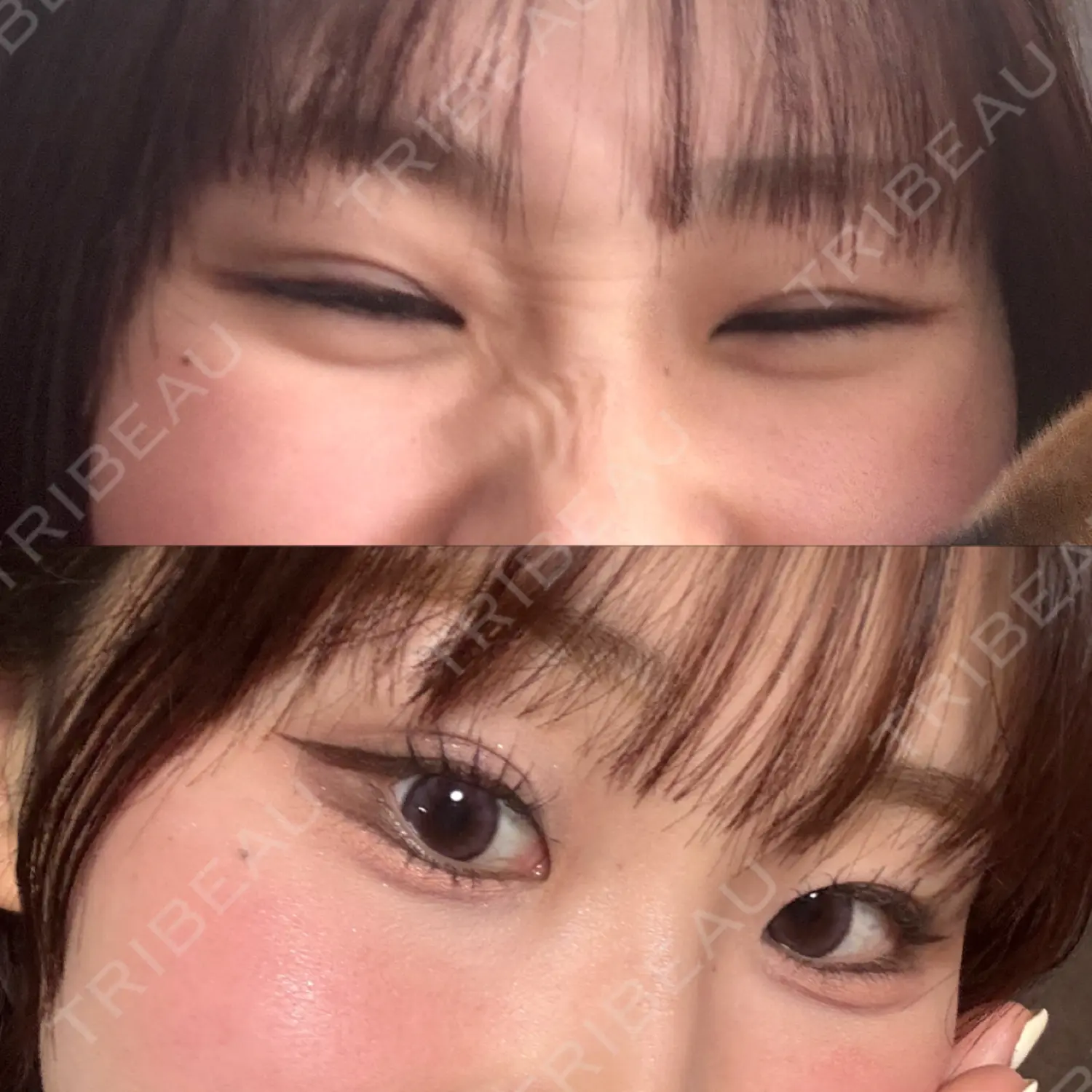 施術後の写真