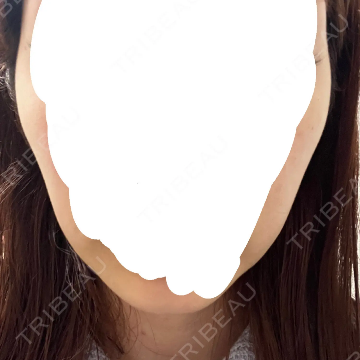 施術後の写真