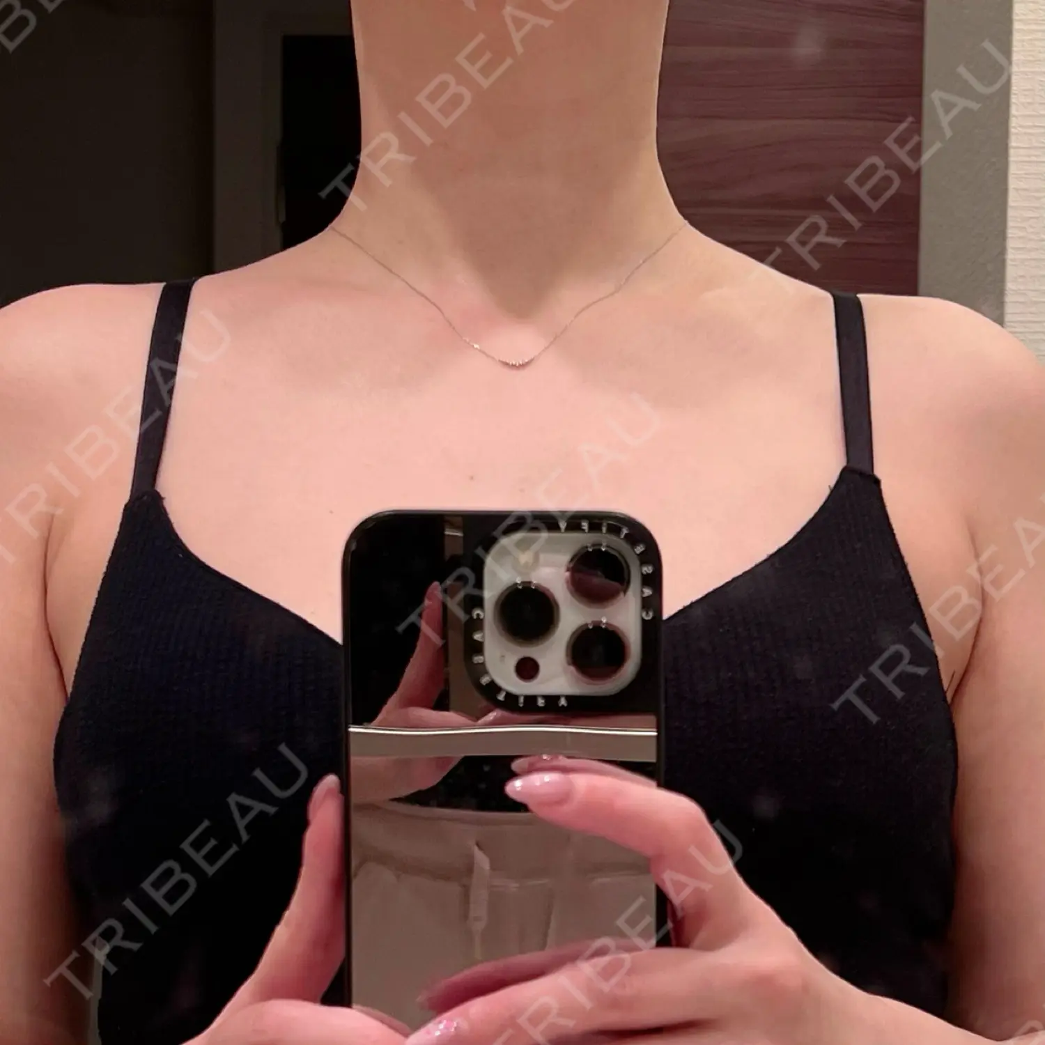 施術後の写真
