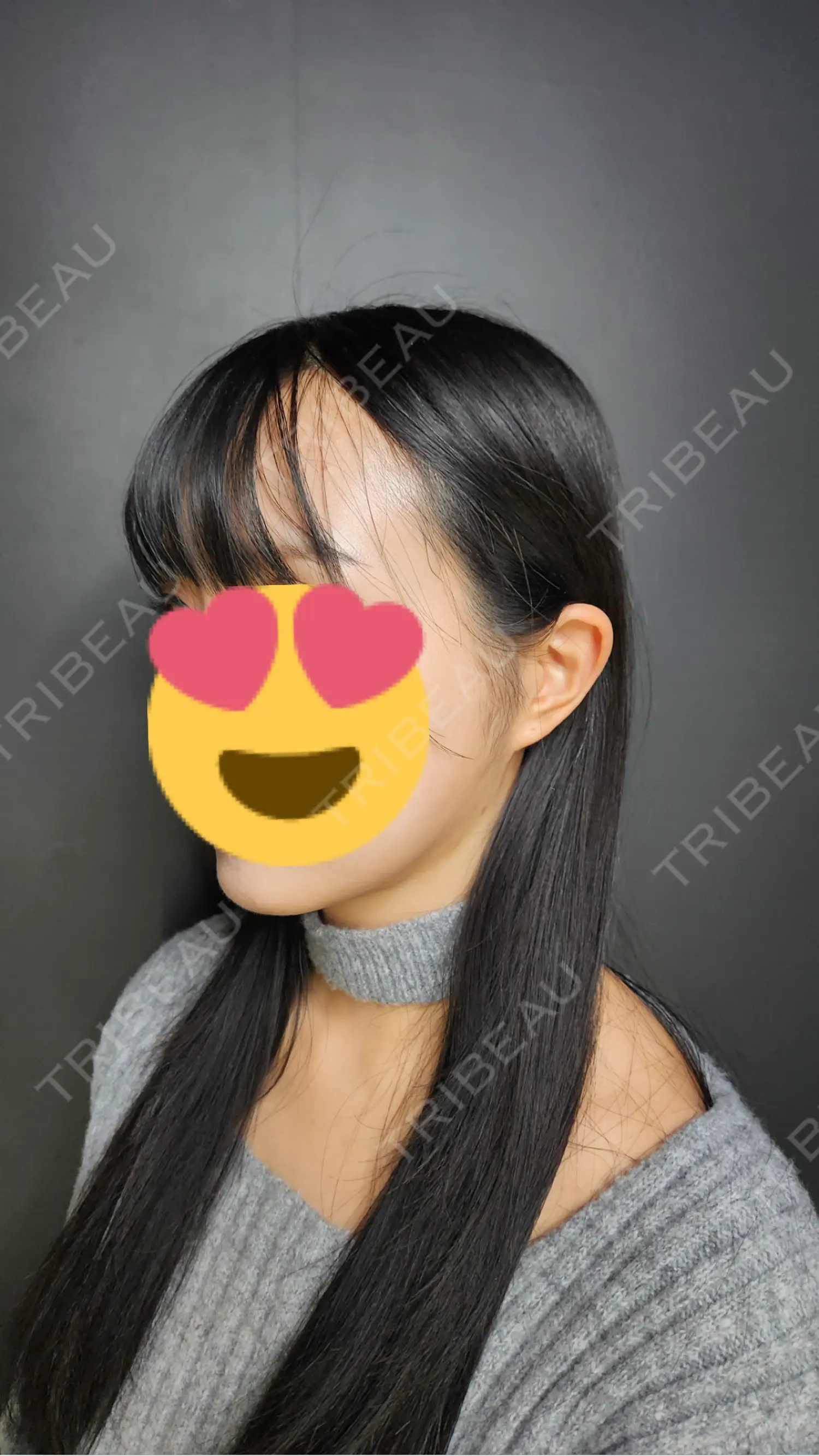 施術後の写真