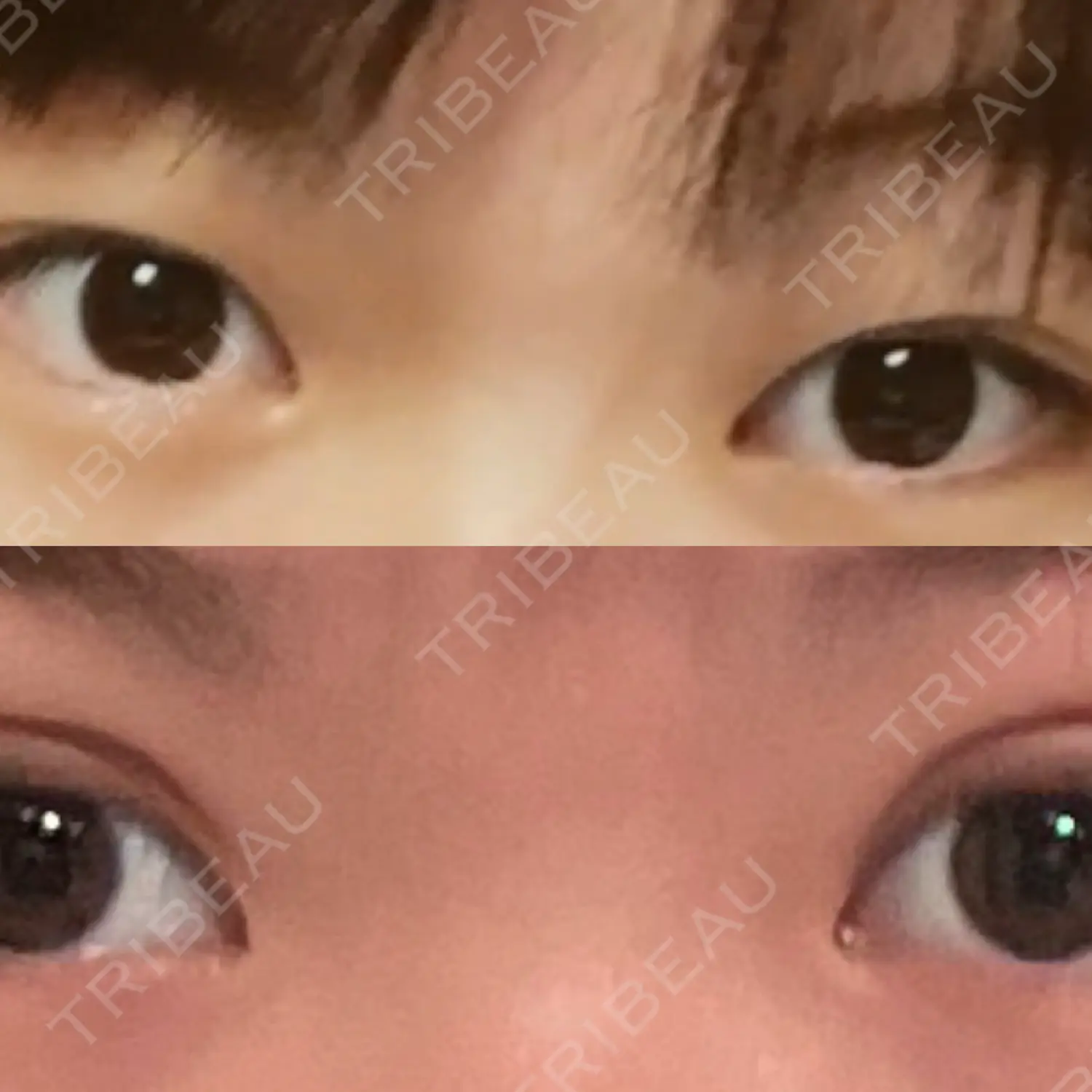施術後の写真