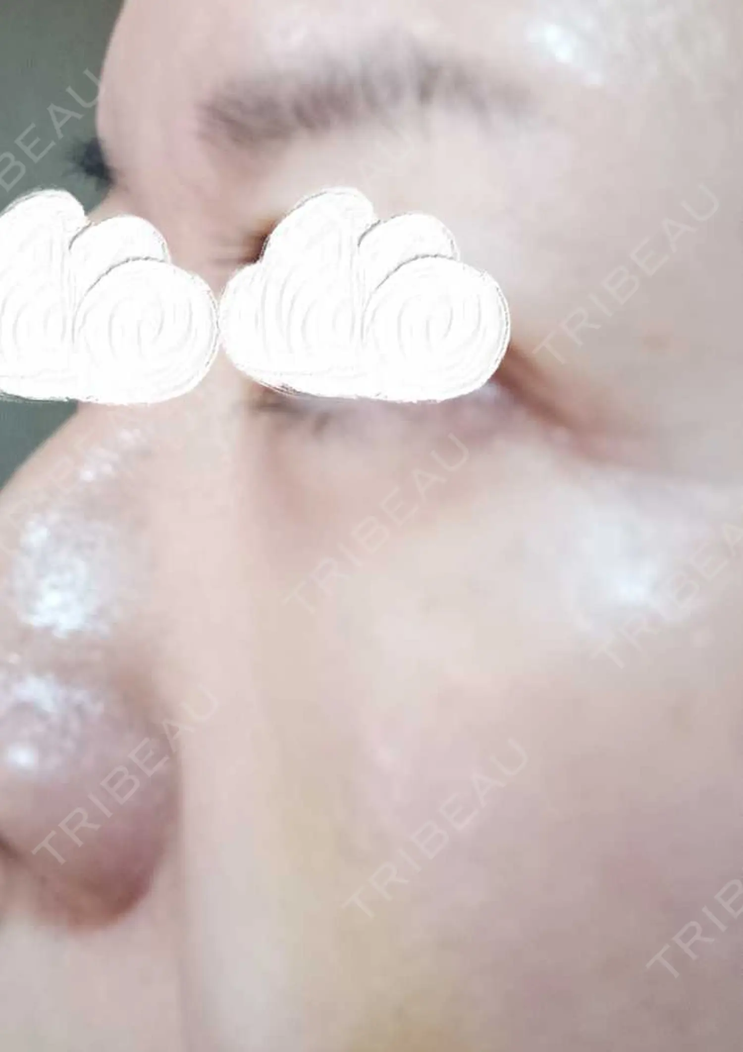 施術後の写真