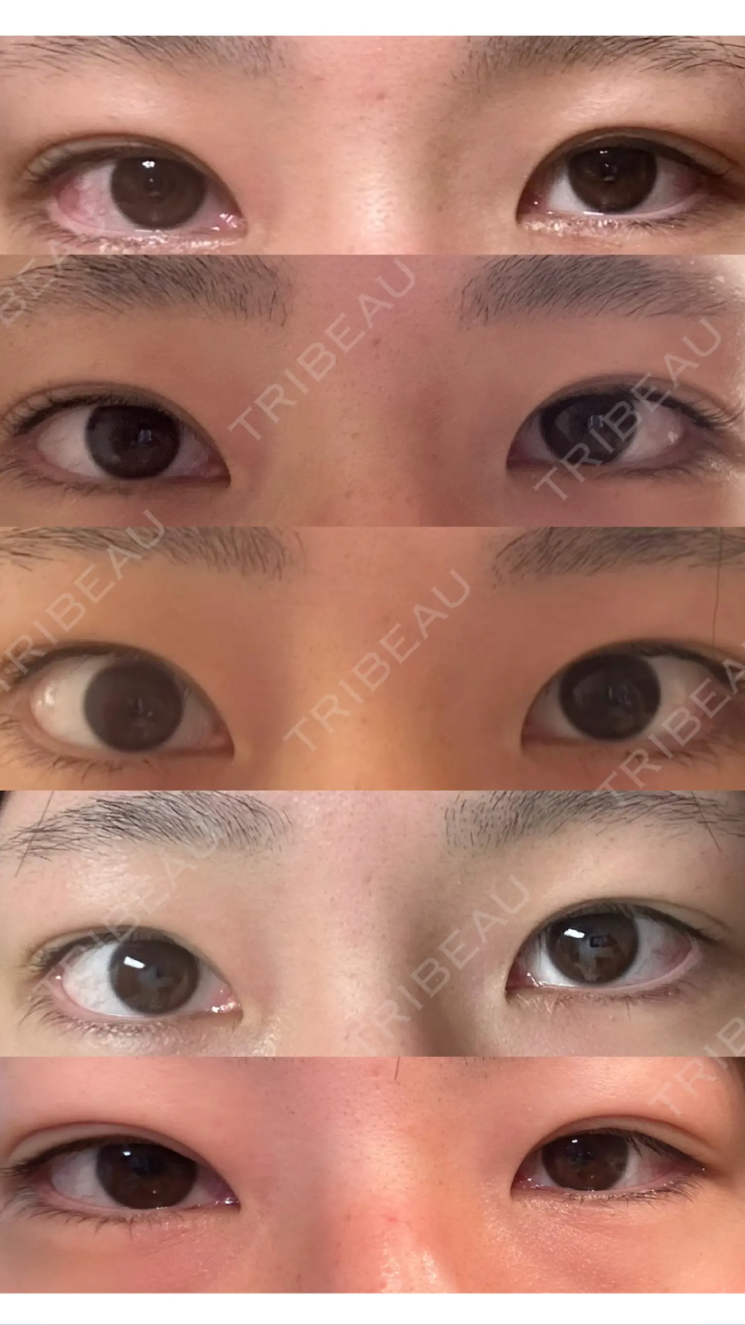 施術後の写真