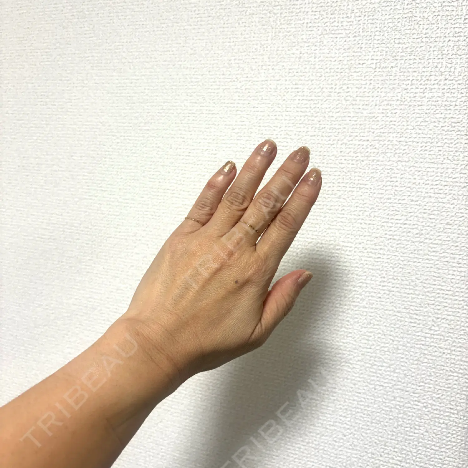 施術後の写真