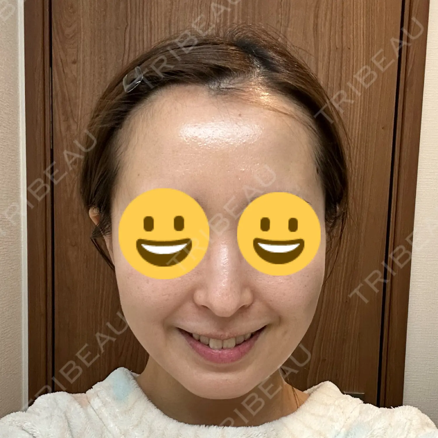 施術後の写真