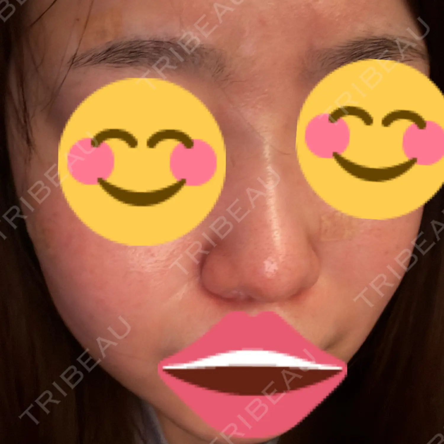 施術後の写真