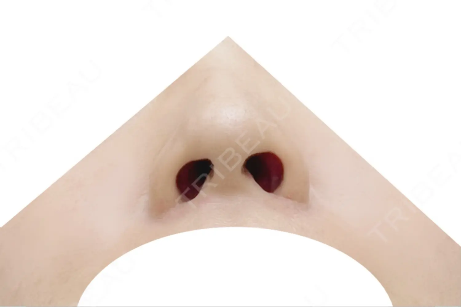 施術後の写真