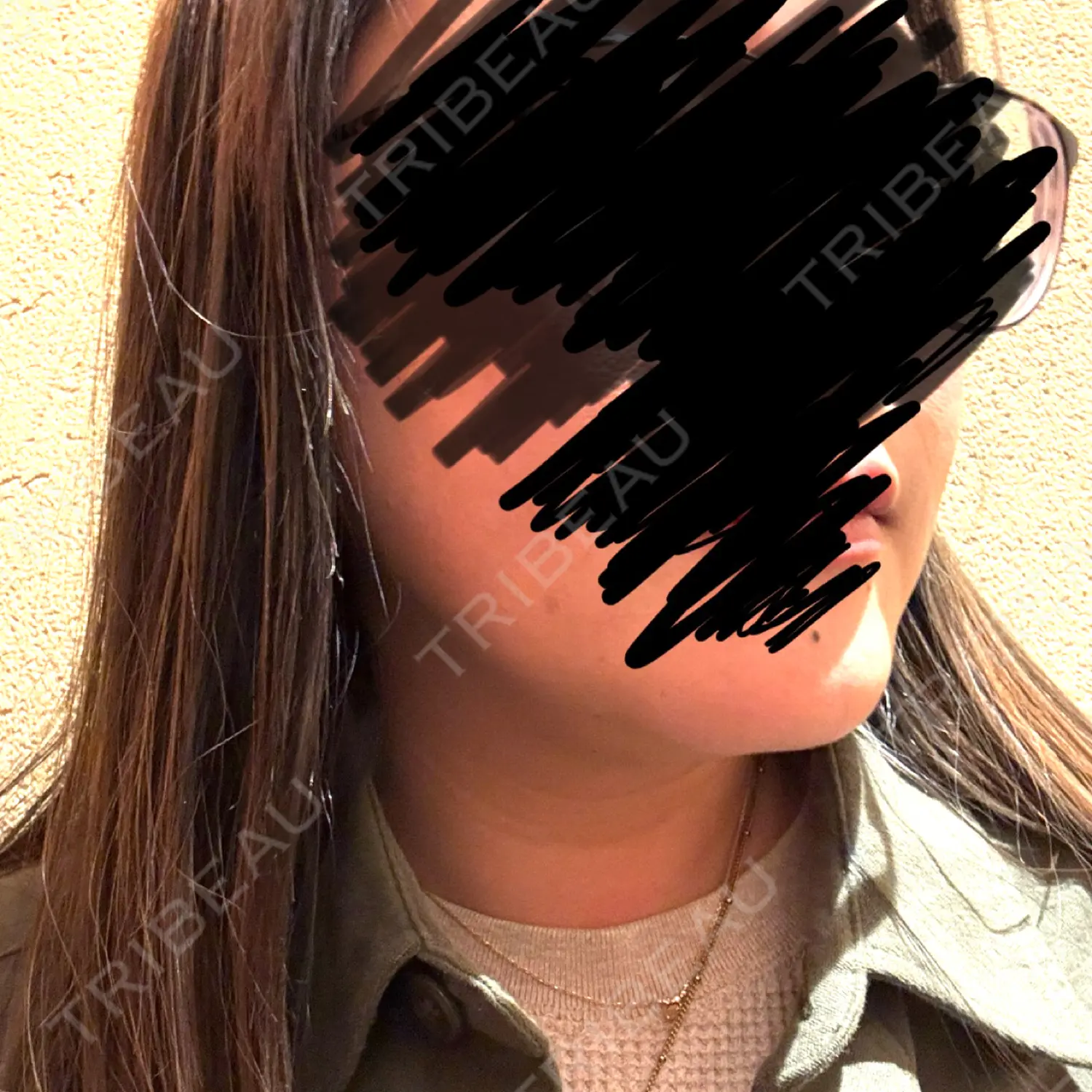 施術後の写真