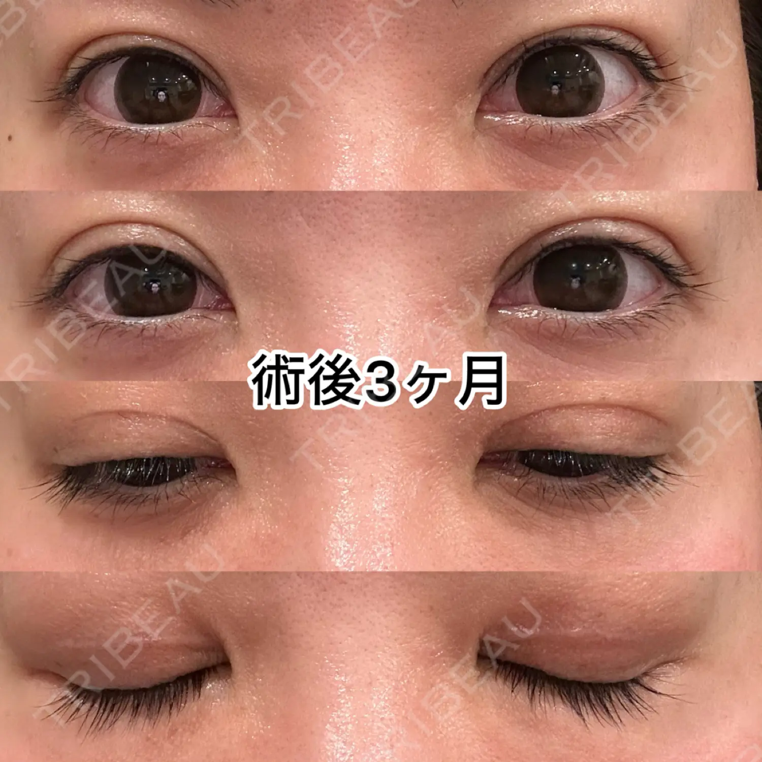 施術後の写真
