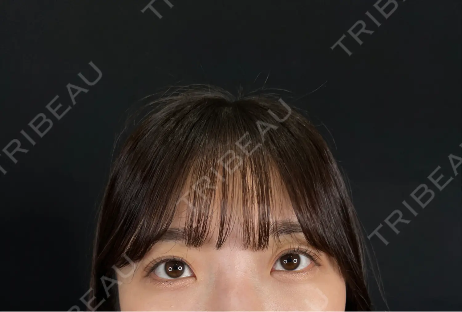 施術後の写真