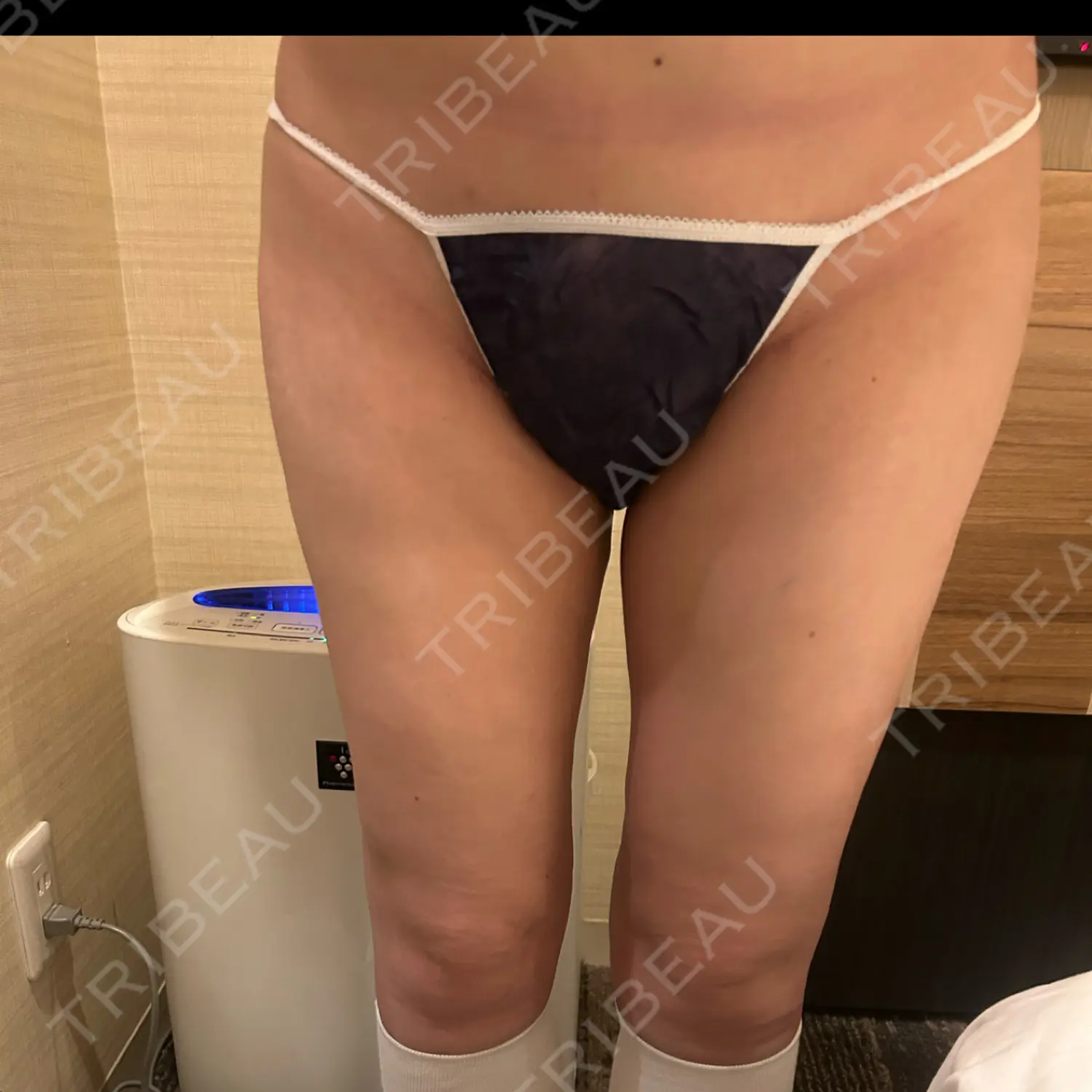 施術後の写真
