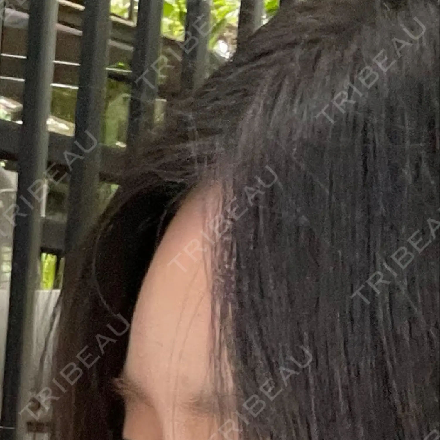 施術後の写真